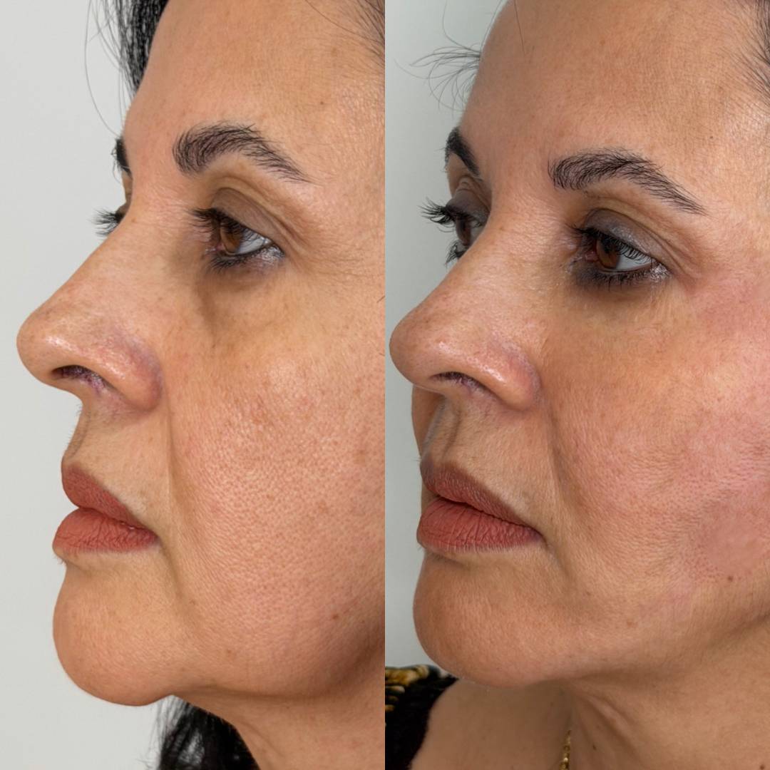 Design sem nome (36)-min