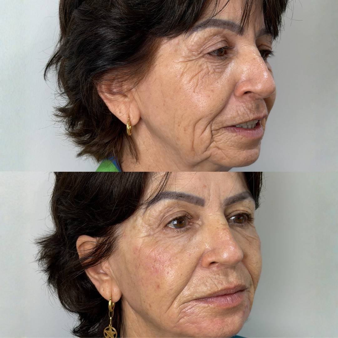 Design sem nome (38)-min