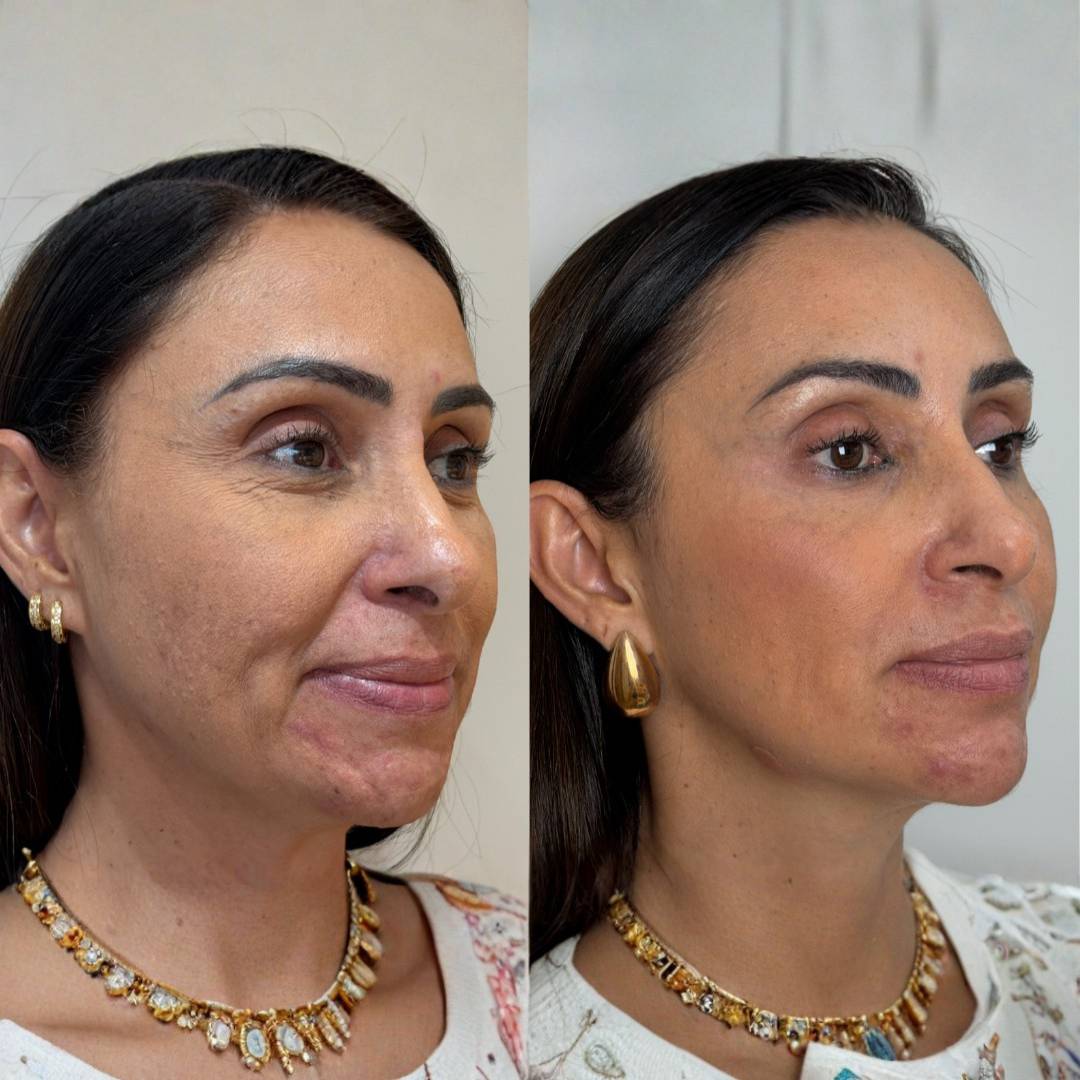 Design sem nome (45)-min